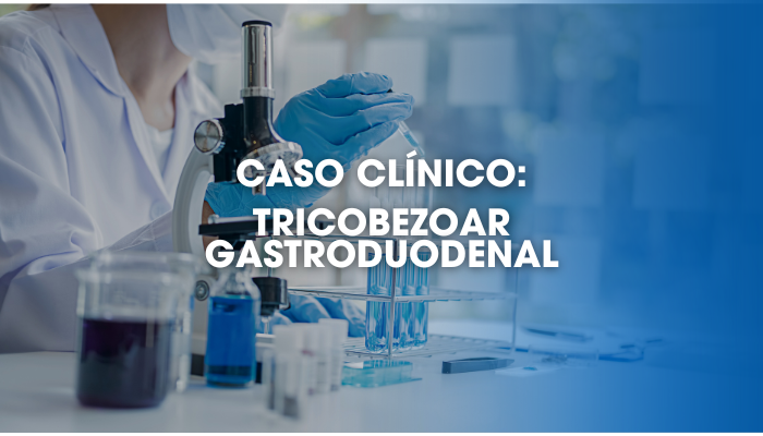 Tricobezoar Gastroduodenal